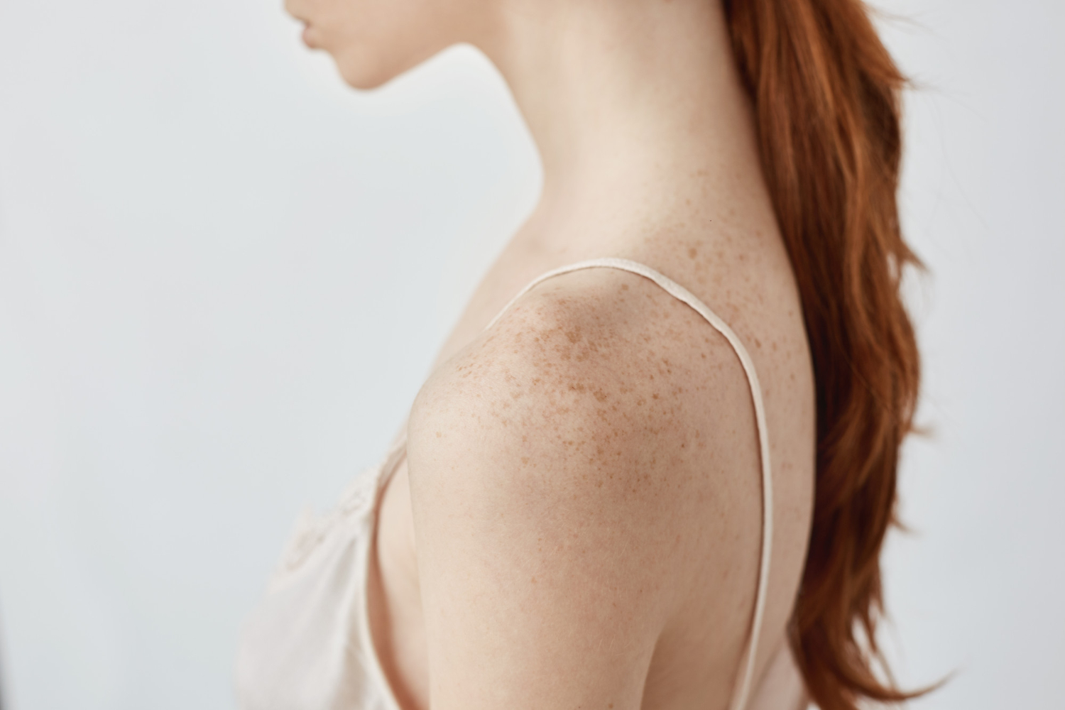 Skin Cancer