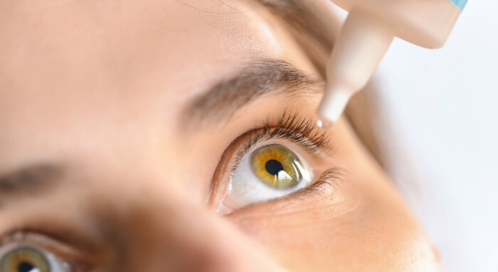 Meibomian Gland Dysfunction